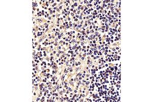 Immunohistochemistry (Paraffin-embedded Sections) (IHC (p)) image for anti-Signal Transducer and Activator of Transcription 5A (STAT5A) (AA 763-797), (C-Term) antibody (ABIN6242561)