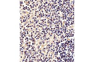 (ABIN6242561 and ABIN6577995) staining STAT5A in Human thymus tissue sections by Immunohistochemistry (IHC-P - paraformaldehyde-fixed, paraffin-embedded sections). (STAT5A 抗体  (C-Term))