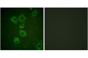 Immunofluorescence analysis of HuvEc cells, using Caspase 6 (Ab-257) Antibody. (Caspase 6 抗体  (AA 223-272))