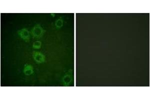 Immunofluorescence analysis of HuvEc cells, using Caspase 6 (Ab-257) Antibody.