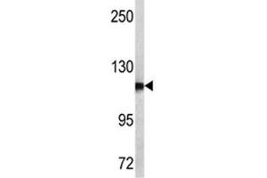 Western blot analysis of NPEPPS antibody and MCF-7 lysate. (NPEPPS 抗体  (AA 709-737))