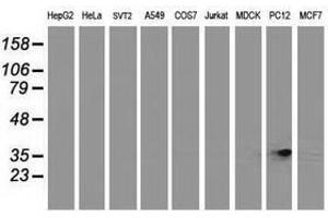 Image no. 3 for anti-Retinol Dehydrogenase 14 (All-Trans/9-Cis/11-Cis) (RDH14) antibody (ABIN1500656) (RDH14 抗体)