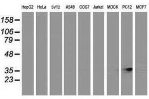 Image no. 3 for anti-Retinol Dehydrogenase 14 (All-Trans/9-Cis/11-Cis) (RDH14) antibody (ABIN1500656)