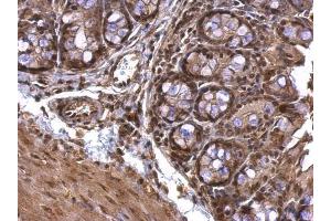 Immunohistochemistry (IHC) image for anti-Acetylcholinesterase (AChE) (C-Term) antibody (ABIN2855111)
