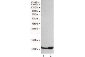 Western blot testing of 1) HeLa and 2) A549 cell lysates with FSP1 antibody at 1:500. (s100a4 抗体)