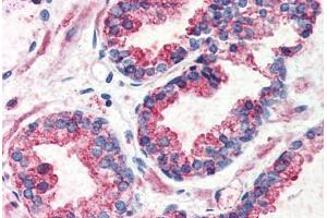 Prostate, Human: Formalin-Fixed, Paraffin-Embedded (FFPE) (G Protein-Coupled Receptor 126 抗体  (N-Term))