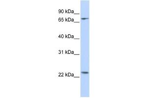 Western Blotting (WB) image for anti-Zinc Finger Protein 185 (ZNF185) antibody (ABIN2458345)