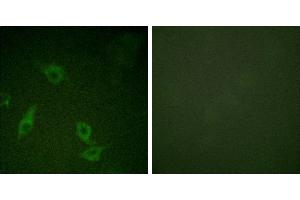 Peptide - +Immunofluorescence analysis of HeLa cells, using FAK (Ab-397) antibody. (FAK 抗体  (Tyr397))