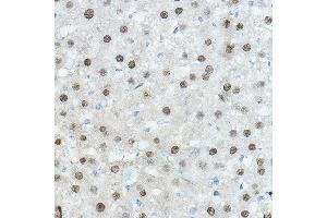 Immunohistochemistry of paraffin-embedded Mouse liver using CEBPA Rabbit pAb (ABIN6131380, ABIN6138380, ABIN6138381 and ABIN6214018) at dilution of 1:100 (40x lens). (CEBPA 抗体  (AA 1-205))
