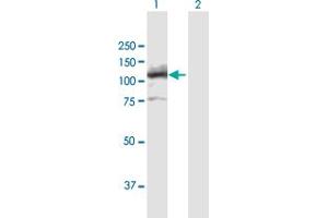 Western Blot analysis of LIG4 expression in transfected 293T cell line by LIG4 MaxPab polyclonal antibody. (LIG4 抗体  (AA 1-911))