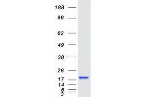 Validation with Western Blot
