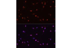 Immunofluorescence analysis of C6 cells using ILF3 antibody (ABIN3023309, ABIN3023310, ABIN3023311 and ABIN6219571) at dilution of 1:100. (Interleukin enhancer-binding factor 3 (ILF3) (AA 1-270) 抗体)