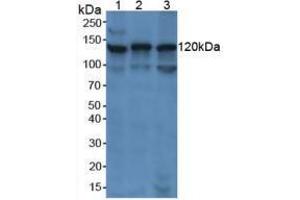 Western blot analysis of (1) Human Jurkat Cells, (2) Human K562 Cells and (3) Human Raji Cells. (PARP1 抗体  (AA 661-881))