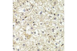 Immunohistochemistry of paraffin-embedded liver injury using LMNB2 antibody at dilution of 1:200 (400x lens). (Lamin B2 抗体)