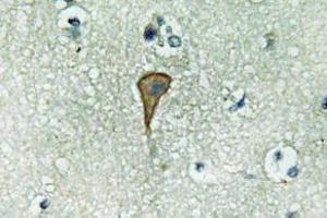 Immunohistochemistry (IHC) analyzes of IL-20Ralpha antibody in paraffin-embedded human brain tissue. (IL20RA 抗体)