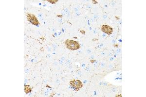 Immunohistochemistry of paraffin-embedded mouse brain using APP Rabbit mAb (ABIN7265575) at dilution of 1:100 (40x lens).