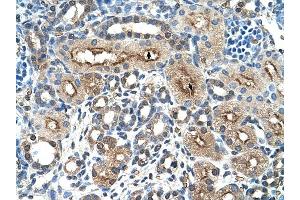 CLEC4M antibody was used for immunohistochemistry at a concentration of 4-8 ug/ml to stain Epithelial cells of renal tubule (arrows) in Human Kidney. (C-Type Lectin Domain Family 4, Member M (CLEC4M) (N-Term) 抗体)