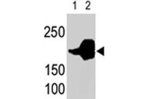 LRP5 polyclonal antibody  is used in Western blot to detect recombinant human LRP5 (Lane 1) and mouse LRP5 (Lane 2) proteins in transfected 293 cell lysates.