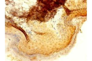 Immunohistochemistry of paraffin-embedded human skin tissue using ABIN7156675 at dilution of 1:100 (IFIT5 抗体  (AA 107-320))