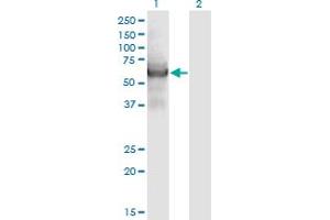 Western Blot analysis of CEP55 expression in transfected 293T cell line by CEP55 monoclonal antibody (M05), clone 6A10. (CEP55 抗体  (AA 1-464))