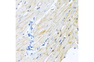 Immunohistochemistry of paraffin-embedded rat heart using ADAM17 antibody. (ADAM17 抗体)