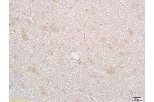 Formalin-fixed and paraffin embedded rat brain tissue labeled with Anti-DRD2 Polyclonal Antibody, Unconjugated  at 1:200, followed by conjugation to the secondary antibody and DAB staining (Dopamine d2 Receptor 抗体  (AA 201-300))