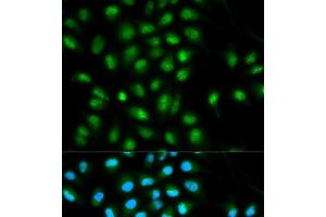 Immunofluorescence analysis of HeLa cells using ASC / TMS1 Polyclonal Antibody (PYCARD 抗体)