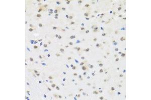 Immunohistochemistry (Paraffin-embedded Sections) (IHC (p)) image for anti-Scaffold Attachment Factor B2 (SAFB2) (AA 1-255) antibody (ABIN1682618)