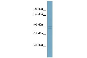 WB Suggested Anti-CXorf66 Antibody Titration:  0. (CXorf66 抗体  (Middle Region))