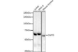 Western blot analysis of extracts of various cell lines, using Z antibody (ABIN7271430) at 1:1000 dilution. (ZAP70 抗体)