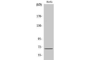 Western Blotting (WB) image for anti-Apoptosis-Inducing Factor, Mitochondrion-Associated, 1 (AIFM1) (N-Term) antibody (ABIN3173712) (AIF 抗体  (N-Term))