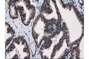 Image no. 1 for anti-Protein Kinase C, epsilon (PRKCE) antibody (ABIN1500228) (PKC epsilon 抗体)