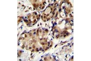 Immunohistochemistry (Paraffin-embedded Sections) (IHC (p)) image for anti-Proline-, Glutamic Acid- and Leucine-Rich Protein 1 (PELP1) (AA 751-779), (Middle Region) antibody (ABIN954085)