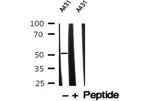 Western blot analysis of A431 whole cell lysates, using Cytokeratin 13 Antibody. (Cytokeratin 13 抗体  (Internal Region))