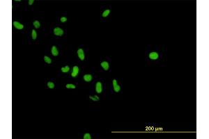 Immunofluorescence of monoclonal antibody to PARP1 on HeLa cell. (PARP1 抗体  (AA 1-100))
