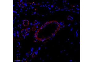 Immunofluorescence of paraffin embedded rat brain using Enfb3 (ABIN7073845) at dilution of 1: 600 (250x lens) (Ephrin B3 抗体)