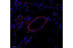 Immunofluorescence of paraffin embedded rat brain using Enfb3 (ABIN7073845) at dilution of 1: 600 (250x lens) (Ephrin B3 抗体)