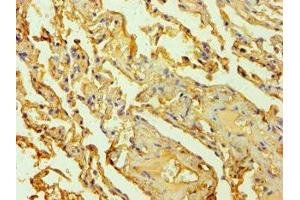 Immunohistochemistry of paraffin-embedded human lung tissue using ABIN7142626 at dilution of 1:100 (Serotonin Receptor 2B 抗体  (AA 382-481))