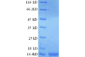 SDS-PAGE (SDS) image for Prostate Stem Cell Antigen (PSCA) (AA 21-95) protein (His tag) (ABIN5712806) (PSCA Protein (AA 21-95) (His tag))