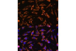 Immunofluorescence analysis of L929 cells using K antibody (ABIN7265613) at dilution of 1:100. (ANKRD15 抗体  (AA 900-1000))