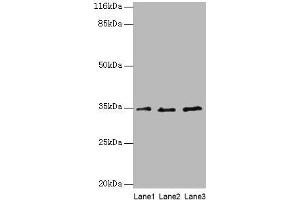 Western blot All lanes: AZGP1 antibody at 4 μg/mL Lane 1: PC-3 whole cell lysate Lane 2: HepG2 whole cell lysate Lane 3: K562 whole cell lysate Secondary Goat polyclonal to rabbit IgG at 1/10000 dilution Predicted band size: 35 kDa Observed band size: 35 kDa (AZGP1 抗体  (AA 61-210))