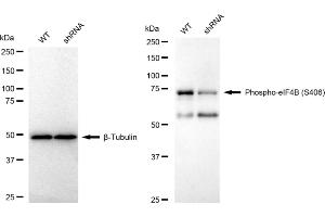 Western blotting analysis using Phospho-eIF4B (S406) antibody (ABIN7798527). (Recombinant EIF4B 抗体  (pSer406))