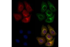 ABIN6263108 and ABIN6266800 staining Hela cells by IF/ICC. (MAP3K6 抗体  (C-Term))