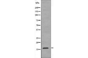 Western blot analysis of extracts from K562 cells, using MRPS18C antibody. (MRPS18C 抗体  (Internal Region))