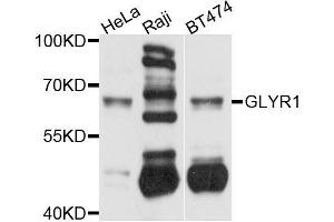 Western blot analysis of extracts of various cell lines, using GLYR1 antibody (ABIN5996127) at 1/1000 dilution. (GLYR1 抗体)