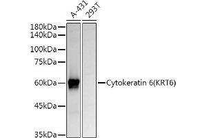 Western blot analysis of extracts of various cell lines, using Cytokeratin 6 (KRT6) Rabbit pAb antibody (ABIN6129605, ABIN6143033, ABIN6143034 and ABIN6223467) at 1:1000 dilution. (KRT6A 抗体  (AA 305-564))
