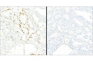 Immunohistochemistry (IHC) image for anti-Tripartite Motif Containing 28 (TRIM28) (pSer824) antibody (ABIN7454038) (Recombinant KAP1 抗体  (pSer824))