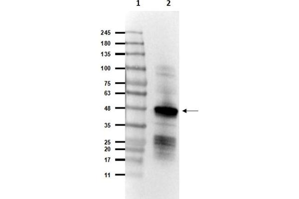 SARS-Coronavirus Nucleocapsid Protein (SARS-CoV N) 抗体