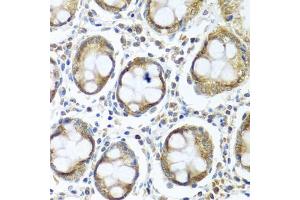 Immunohistochemistry of paraffin-embedded human colon using IFI44 antibody (ABIN5974803) at dilution of 1/100 (40x lens). (IFI44 抗体)