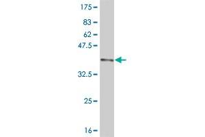 Western Blot detection against Immunogen (36. (DNMBP 抗体  (AA 491-590))